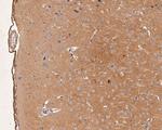 GABRA1 Antibody in Immunohistochemistry (Paraffin) (IHC (P))