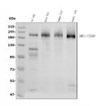 MRC1 Antibody in Western Blot (WB)