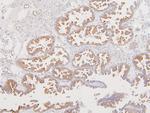 ATP5G1/2/3 Antibody in Immunohistochemistry (Paraffin) (IHC (P))