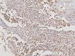 ATP5G1/2/3 Antibody in Immunohistochemistry (Paraffin) (IHC (P))