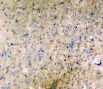 LRTOMT Antibody in Immunohistochemistry (Paraffin) (IHC (P))