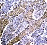 LRTOMT Antibody in Immunohistochemistry (Paraffin) (IHC (P))