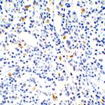 IL-17A Antibody in Immunohistochemistry (Paraffin) (IHC (P))