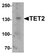 TET2 Antibody in Western Blot (WB)