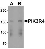 PIK3R4 Antibody in Western Blot (WB)