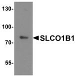 OATP2 Antibody in Western Blot (WB)