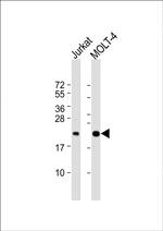 CD3z Antibody in Western Blot (WB)