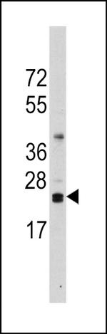 CD3z Antibody in Western Blot (WB)