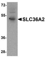 SLC36A2 Antibody in Western Blot (WB)