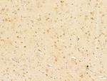 Phospho-C-Jun (Ser73) Antibody in Immunohistochemistry (Paraffin) (IHC (P))