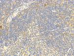 Phospho-C-Jun (Ser73) Antibody in Immunohistochemistry (Paraffin) (IHC (P))