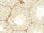 Phospho-C-Jun (Ser73) Antibody in Immunohistochemistry (Paraffin) (IHC (P))