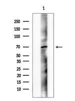 Phospho-PAK4/5/6 (Ser474) Antibody in Western Blot (WB)