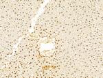 Phospho-RB1 (Ser780) Antibody in Immunohistochemistry (Paraffin) (IHC (P))