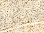 Phospho-RB1 (Ser780) Antibody in Immunohistochemistry (Paraffin) (IHC (P))