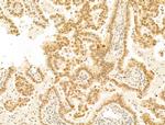 Phospho-RB1 (Ser780) Antibody in Immunohistochemistry (Paraffin) (IHC (P))