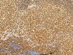 Phospho-RB1 (Ser780) Antibody in Immunohistochemistry (Paraffin) (IHC (P))