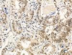 Phospho-TDP-43 (Ser409, Ser410) Antibody in Immunohistochemistry (Paraffin) (IHC (P))