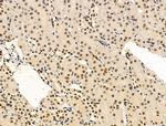 Phospho-TDP-43 (Ser409, Ser410) Antibody in Immunohistochemistry (Paraffin) (IHC (P))