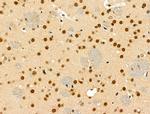 Phospho-TDP-43 (Ser409, Ser410) Antibody in Immunohistochemistry (Paraffin) (IHC (P))