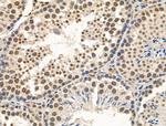 Phospho-TDP-43 (Ser409, Ser410) Antibody in Immunohistochemistry (Paraffin) (IHC (P))