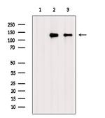 Phospho-ZO-2 (Tyr1118) Antibody in Western Blot (WB)