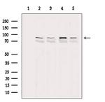 PARP1 (Cleaved Asp214) Antibody in Western Blot (WB)