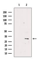 CACNG5 Antibody in Western Blot (WB)