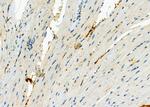 CACNG8 Antibody in Immunohistochemistry (Paraffin) (IHC (P))