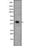 CACNG8 Antibody in Western Blot (WB)