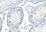 CITED4 Antibody in Immunohistochemistry (Paraffin) (IHC (P))