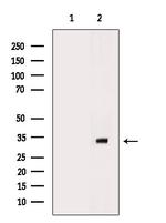 RAD1 Antibody in Western Blot (WB)