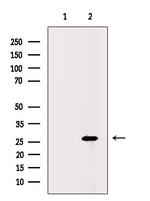 UBC3B Antibody in Western Blot (WB)