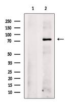 CBX4 Antibody in Western Blot (WB)