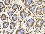 CDK8 Antibody in Immunohistochemistry (Paraffin) (IHC (P))