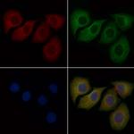 PPBP Antibody in Immunocytochemistry (ICC/IF)