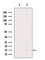 PPBP Antibody in Western Blot (WB)