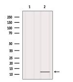 COX6A1 Antibody in Western Blot (WB)