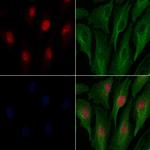 DFFB Antibody in Immunocytochemistry (ICC/IF)