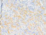 DGAT1 Antibody in Immunohistochemistry (Paraffin) (IHC (P))