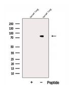 DLL1 Antibody in Western Blot (WB)