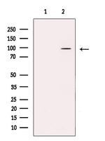 DPP6 Antibody in Western Blot (WB)