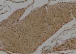 DVL3 Antibody in Immunohistochemistry (Paraffin) (IHC (P))