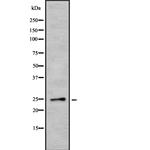 EBI3 Antibody in Western Blot (WB)