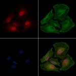 eIF4H Antibody in Immunocytochemistry (ICC/IF)