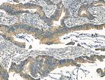 KCNN3 Antibody in Immunohistochemistry (Paraffin) (IHC (P))