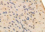 LIS1 Antibody in Immunohistochemistry (Paraffin) (IHC (P))