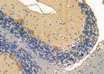 LIS1 Antibody in Immunohistochemistry (Paraffin) (IHC (P))