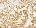 MACC1 Antibody in Immunohistochemistry (Paraffin) (IHC (P))