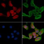 MMP1 Antibody in Immunocytochemistry (ICC/IF)